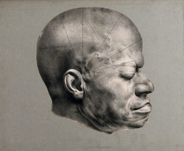 Death mask of Eustache, a slave from the Dominican republic, who was awarded a ‘prize for virtue’ for his role in the destruction of a slave uprising. The mask shows five divisions across the man’s skull that were then used as ‘scientific’ evidence for medical knowledge.
