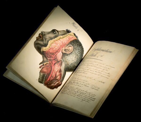 A book. The left page contains a hand-colored illustration of a Black man's head, turned to the side and dissected to reveal the carotid arteries. On the right page is a hand-written explanatory note.
